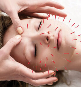 Acupuncture/Acupressure at Maryam Health Care